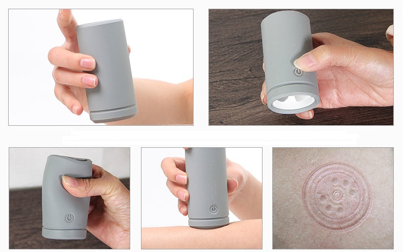 Luxury Electric Silicone Cupping Therapy Massager — EMS Pulse Full Body Massage & Vacuum Suction Wellness Device — Prime Trend Market