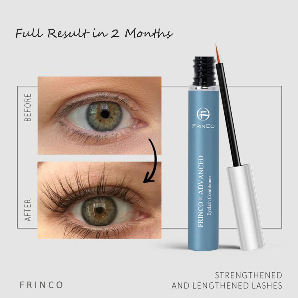Advanced Eyelash Enhancing Serum — Fuller, Thicker Lashes & Brow Growth | 5ml — Prime Trend Market