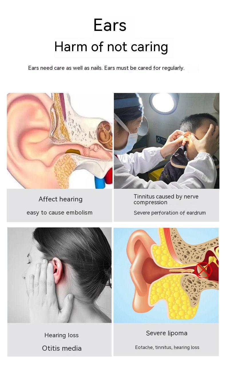 Wireless HD Ear Endoscope — Smart Luminous Ear Pick with 1296p Camera — Eliza & Tuan