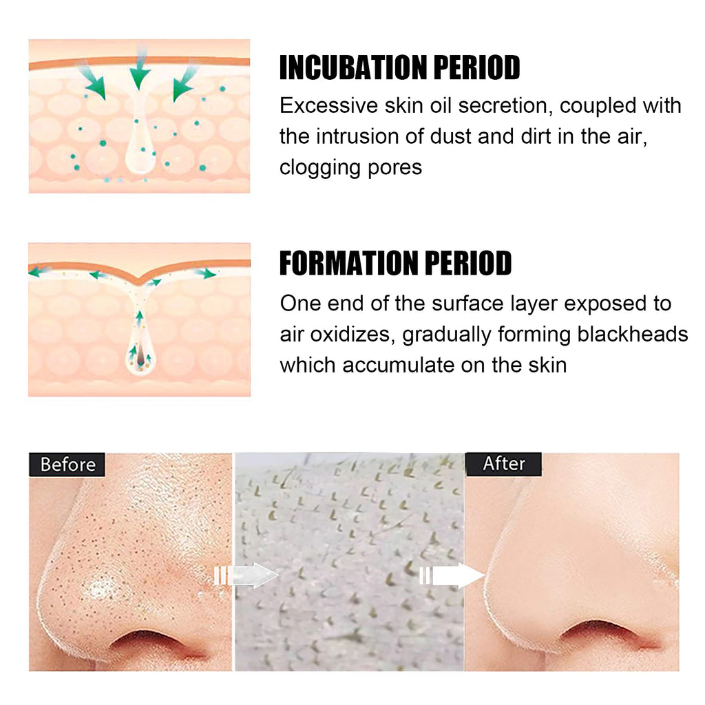 Blackhead Remover Kit — 15g Cream + 40 Pore Strips | Clear Smooth Skin — Prime Trend Market