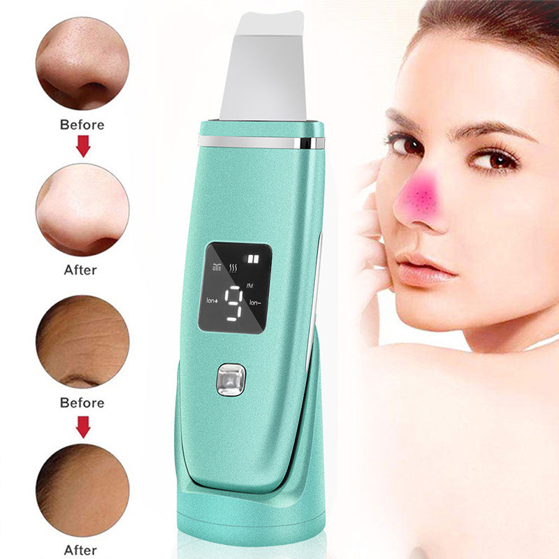 Ultrasonic Skin Scrubber | 4-in-1 Blackhead Remover & Deep Pore Cleansing Beauty Device — Prime Trend Market