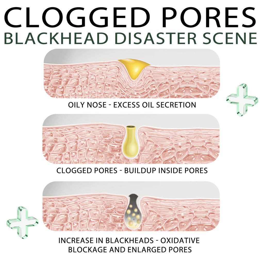 Blackhead Remover Kit — 15g Cream + 40 Pore Strips | Clear Smooth Skin — Prime Trend Market